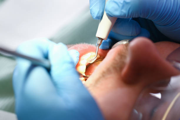 Professional Emergency Dental Service in NC