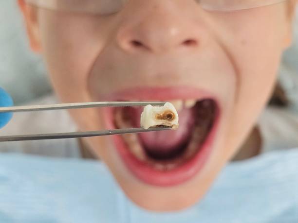 Best Emergency Denture Repair in Rowland, NC